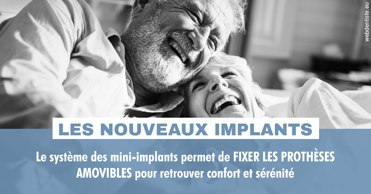 https://www.dentistesbeal.fr/Les nouveaux implants 2