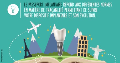 https://www.dentistesbeal.fr/Le passeport implantaire
