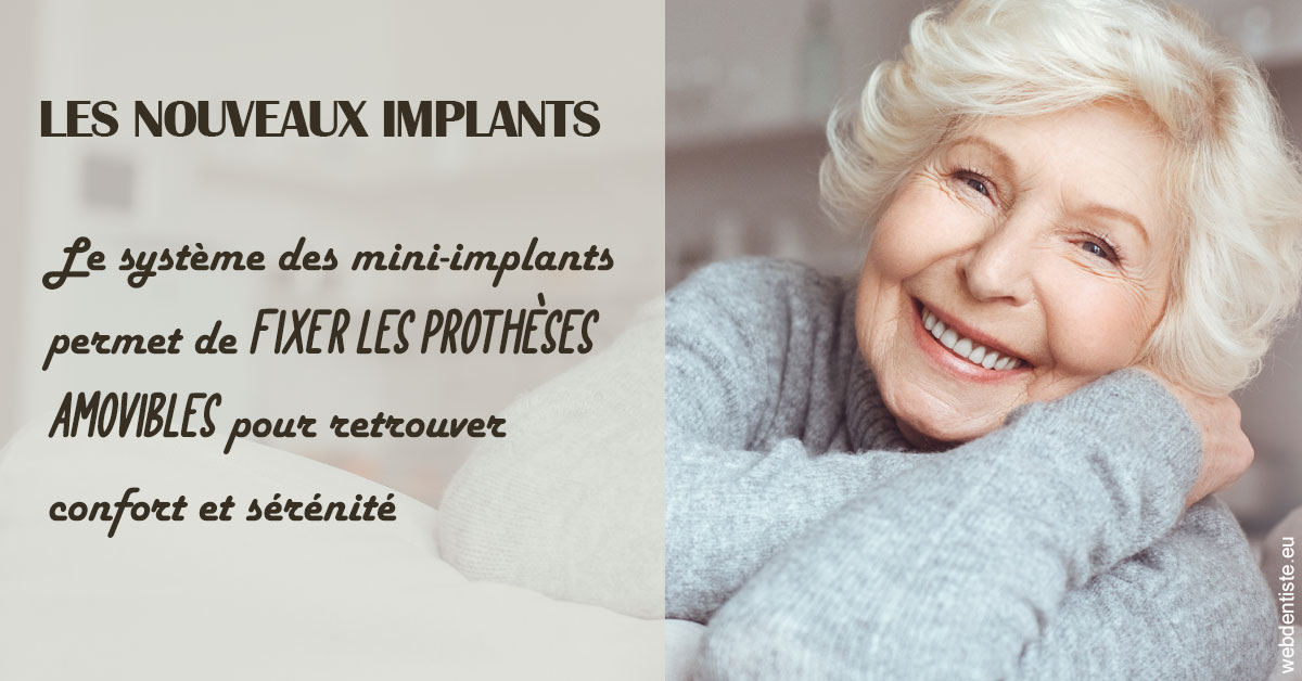 https://www.dentistesbeal.fr/Les nouveaux implants 1