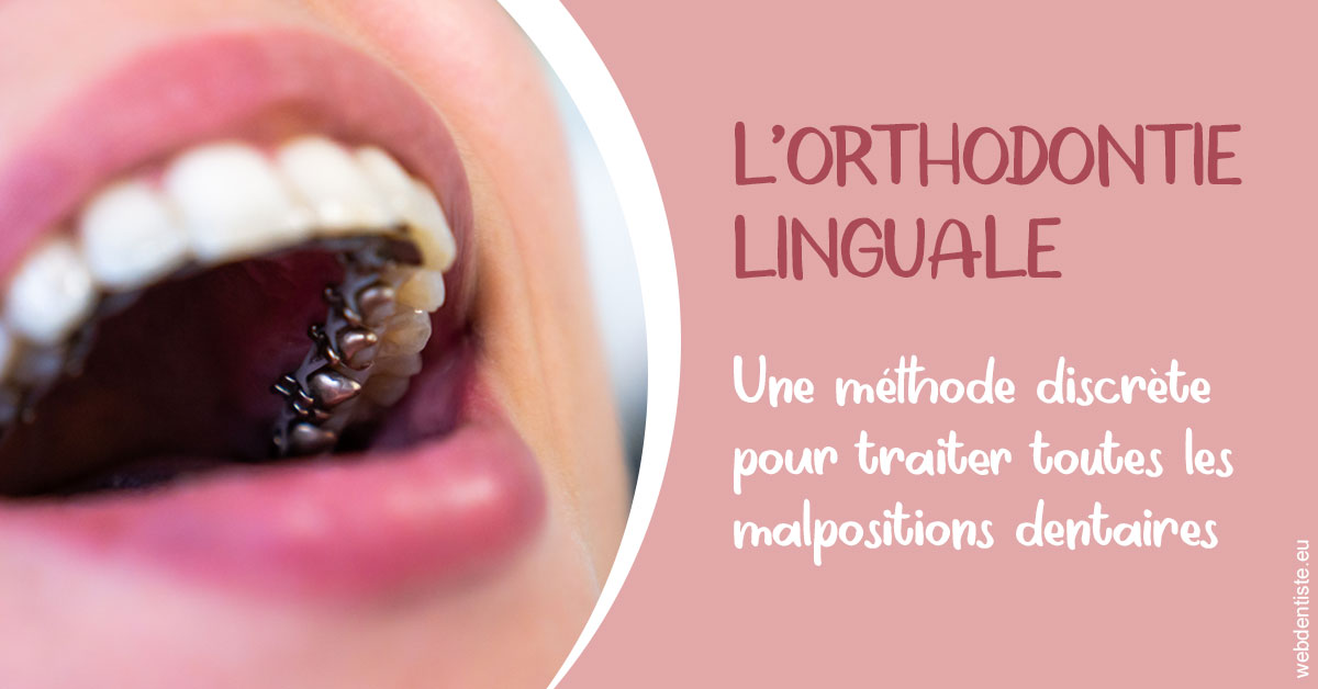 https://www.dentistesbeal.fr/L'orthodontie linguale 2