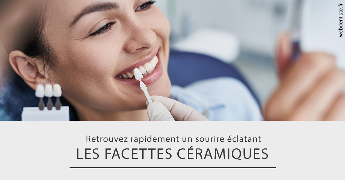 https://www.dentistesbeal.fr/Les facettes céramiques 2