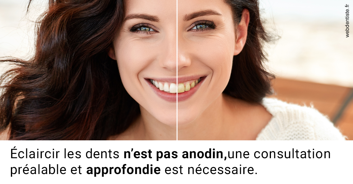 https://www.dentistesbeal.fr/Le blanchiment 2