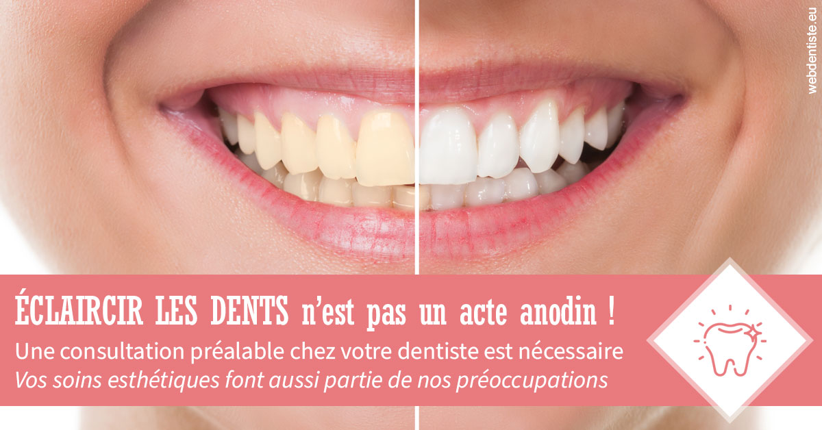 https://www.dentistesbeal.fr/Eclaircir les dents 1