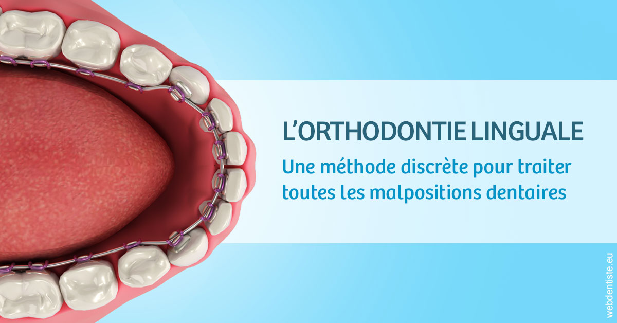 https://www.dentistesbeal.fr/L'orthodontie linguale 1