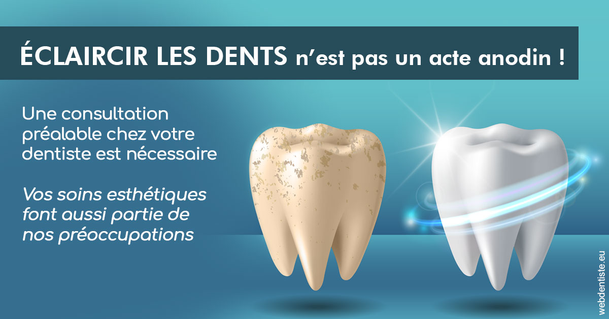 https://www.dentistesbeal.fr/Eclaircir les dents 2