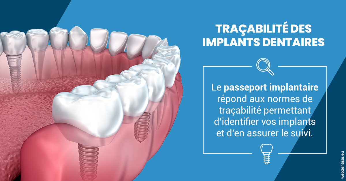 https://www.dentistesbeal.fr/T2 2023 - Traçabilité des implants 1