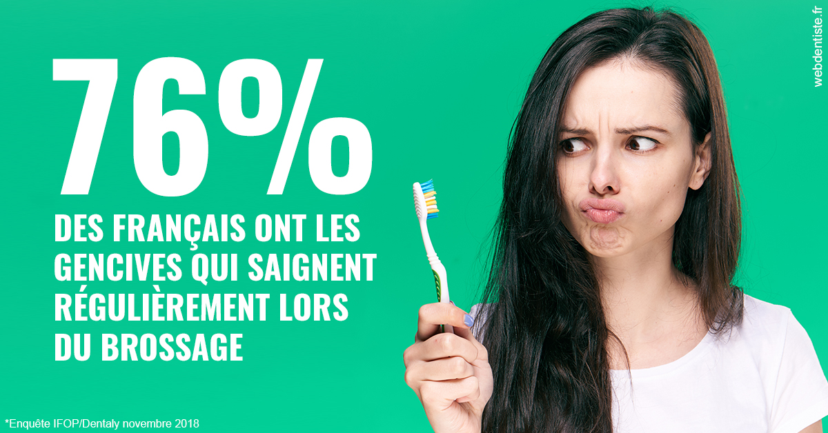 https://www.dentistesbeal.fr/76% des Français 1
