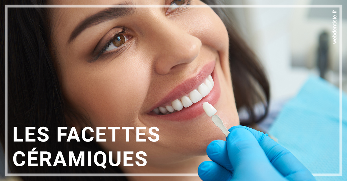 https://www.dentistesbeal.fr/Les facettes céramiques 1