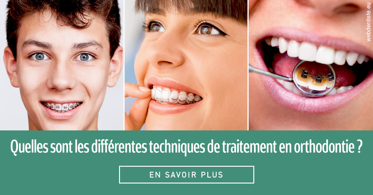 https://www.dentistesbeal.fr/Les différentes techniques de traitement 2