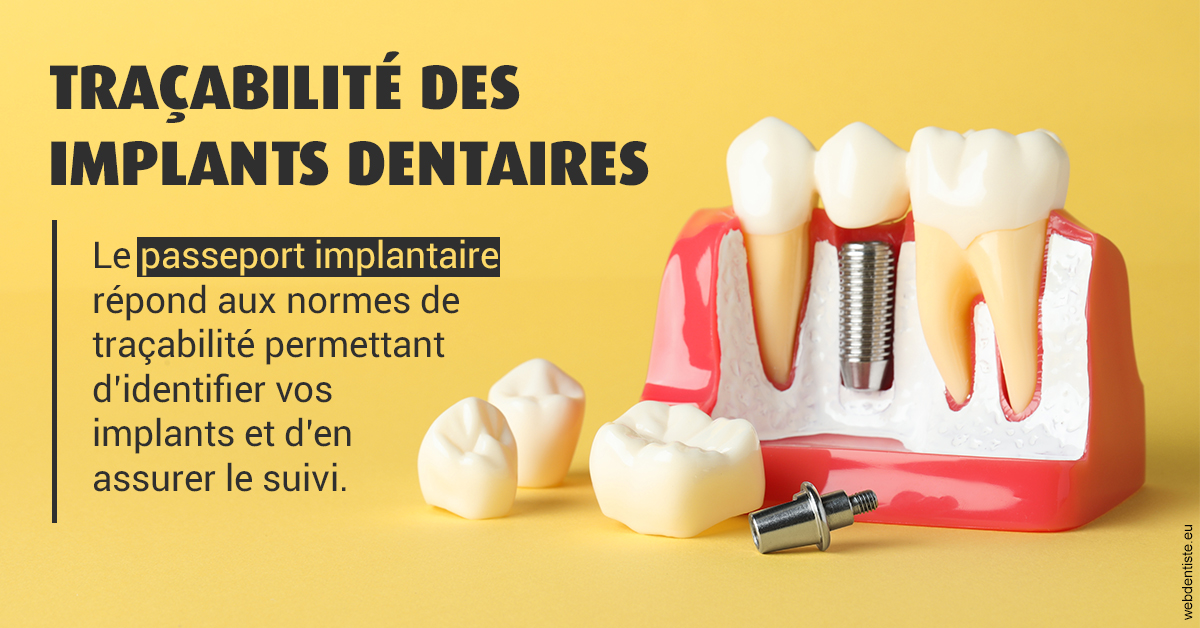 https://www.dentistesbeal.fr/T2 2023 - Traçabilité des implants 2