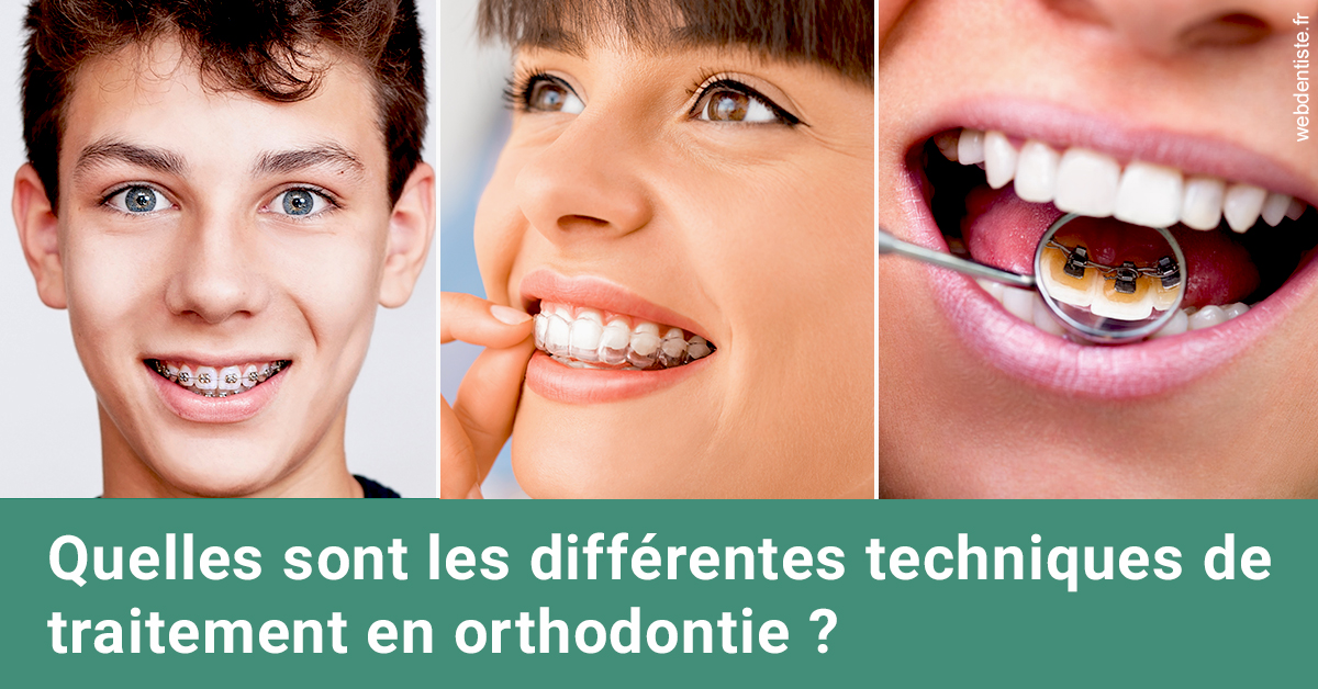 https://www.dentistesbeal.fr/Les différentes techniques de traitement 2