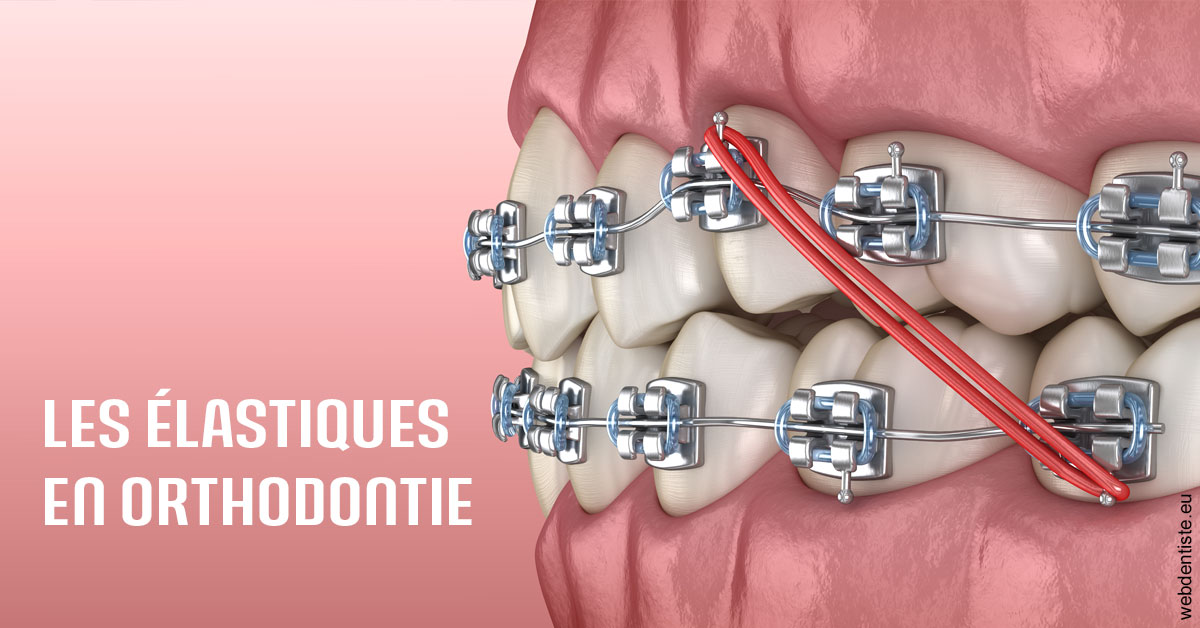 https://www.dentistesbeal.fr/Elastiques orthodontie 2