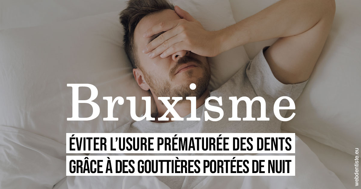 https://www.dentistesbeal.fr/Bruxisme 1