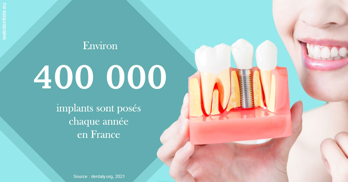 https://www.dentistesbeal.fr/Pose d'implants en France 2
