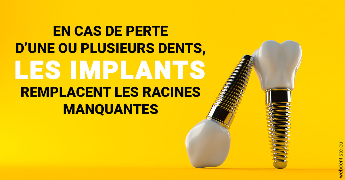 https://www.dentistesbeal.fr/Les implants 2