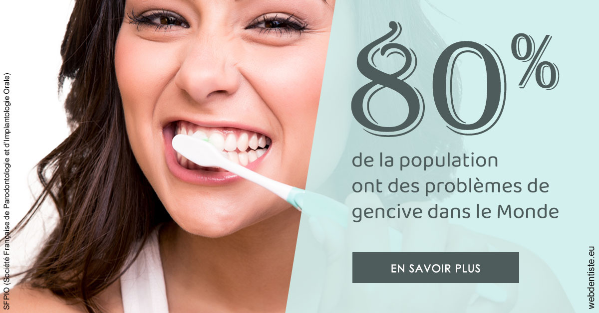 https://www.dentistesbeal.fr/Problèmes de gencive 1