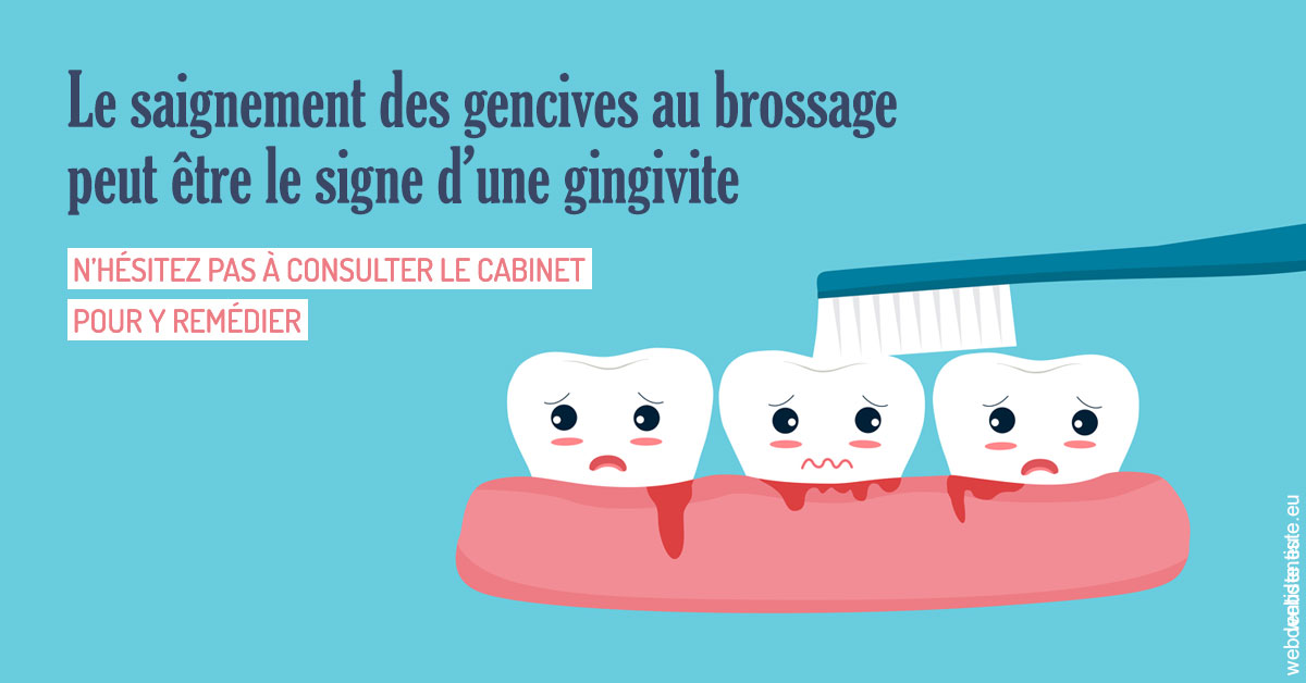 https://www.dentistesbeal.fr/2023 T4 - Saignement des gencives 02